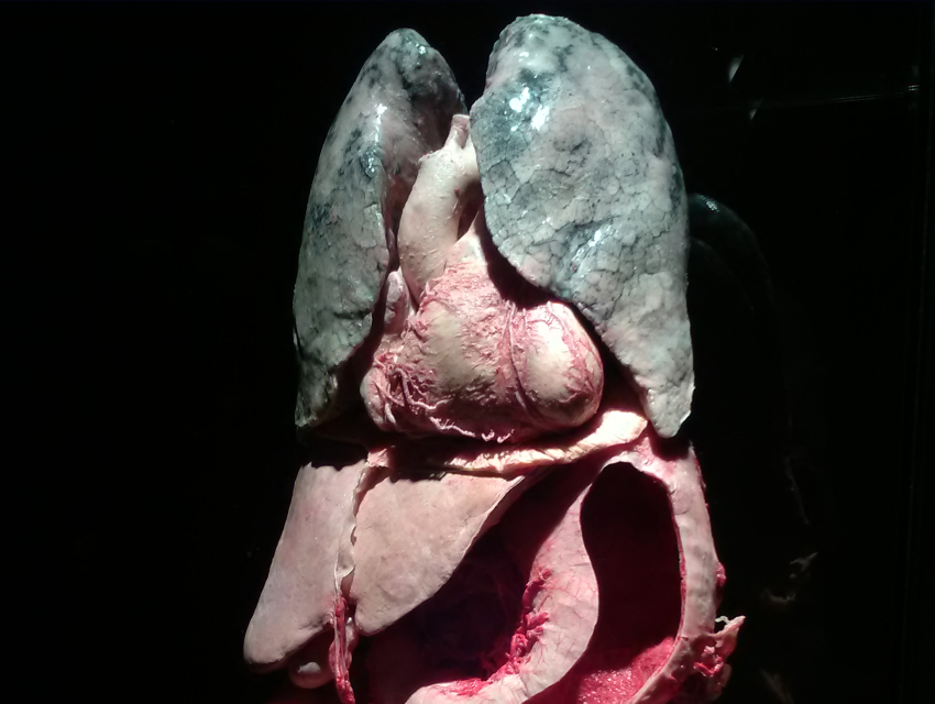 Body Worlds